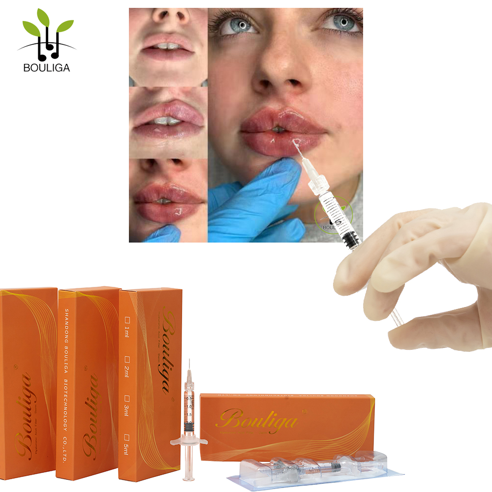 Bouliga Hautfüller 2 ml 100 % Hyaluronsäure 20 mg/ml Konzentration für Lip Glow Up